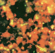 orange-stained bacteria